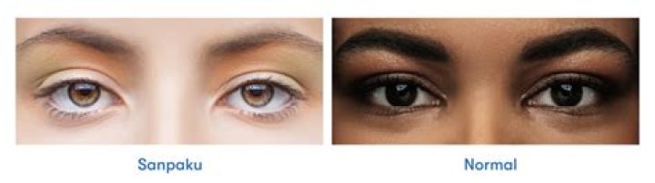Are Sanpaku eyes good?