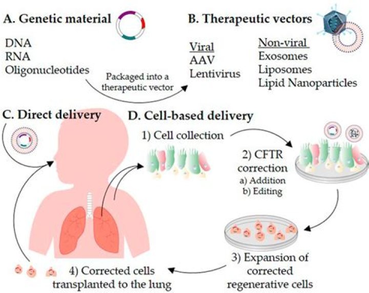 Can cystic fibrosis be cured by gene therapy?