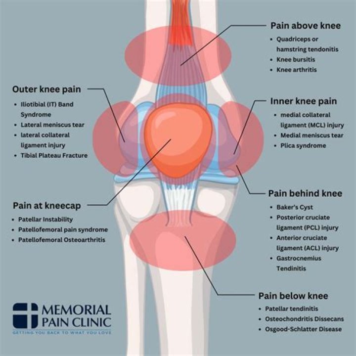 Can foot and knee pain be related?