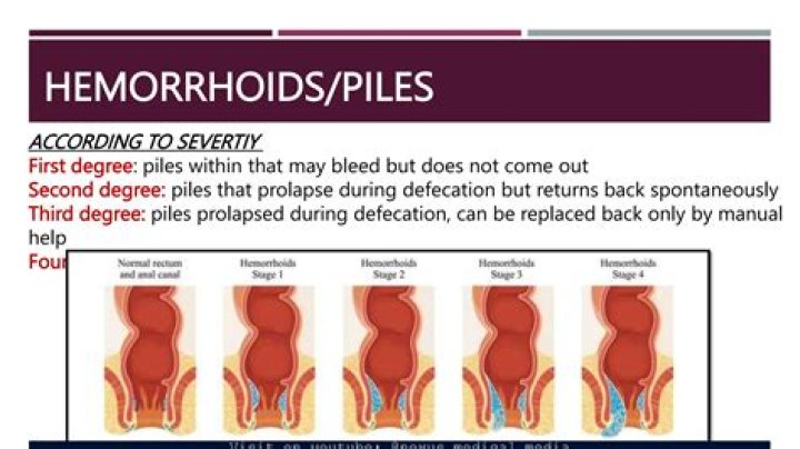 Can hemorrhoids bleed dark?