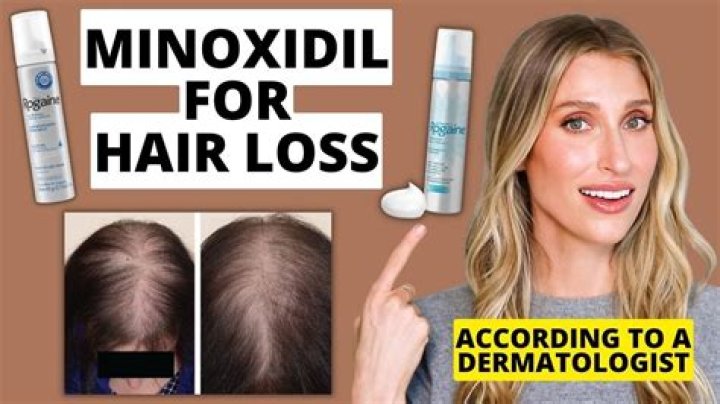 Can I use minoxidil once per day?
