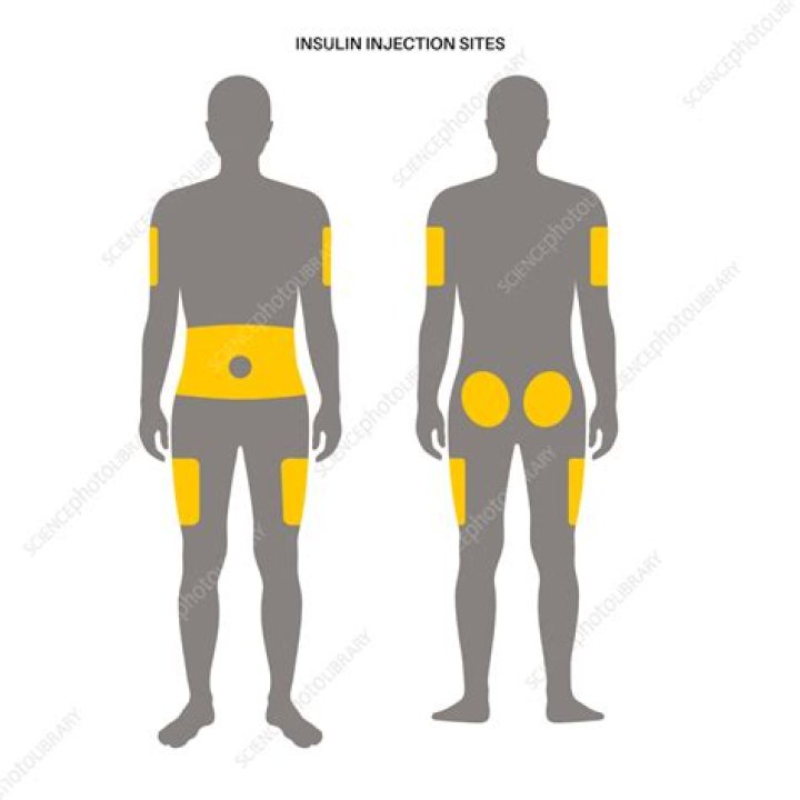 Can insulin be injected in the thigh?