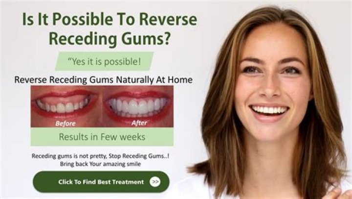 Can mouthwash reverse receding gums?