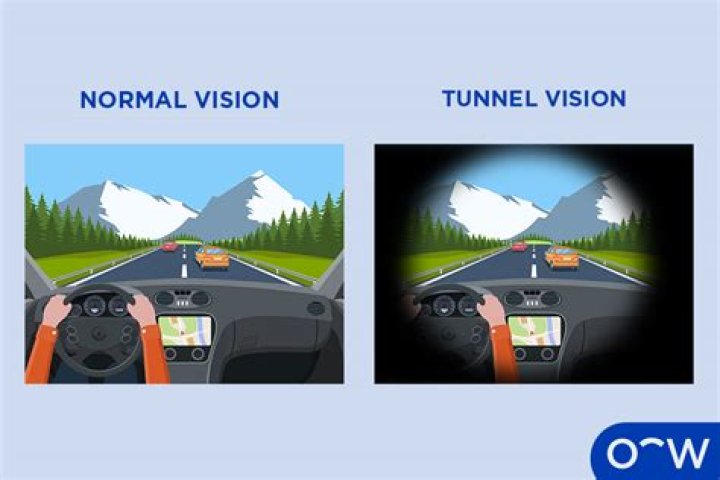 Can people with glaucoma fly in an airplane?