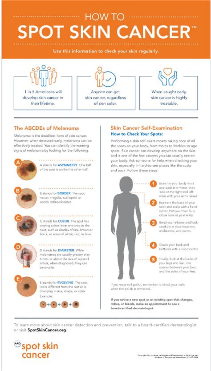 Can skin cancer look like white spots?