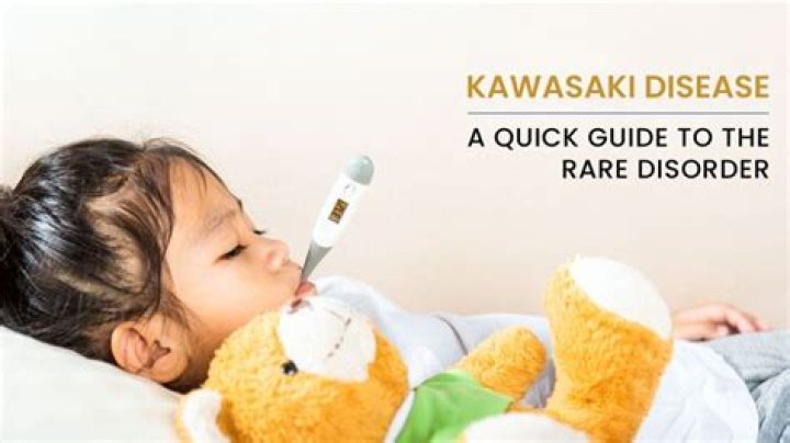 Can you get Kawasaki disease from carpet cleaning?