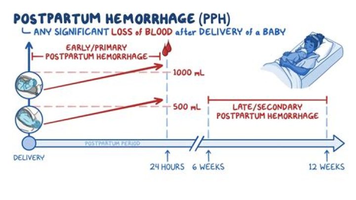 Can you hemorrhage 3 weeks postpartum?