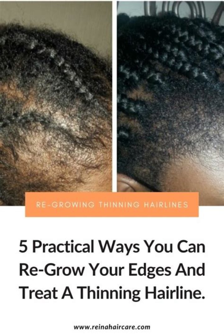 Can you regrow edges?
