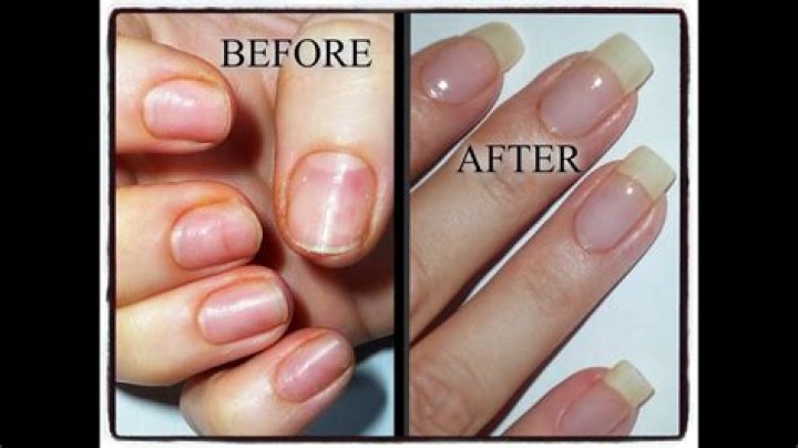 Do acrylic nails ruin your real nails?