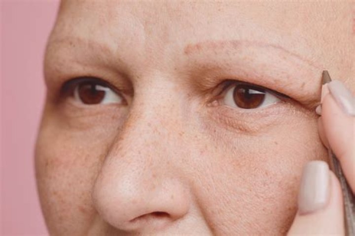 Do eyebrows grow back after thyroid?