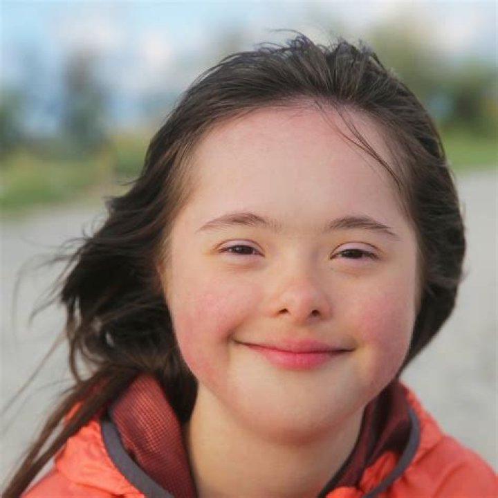 Do people with Down syndrome have specific facial features?