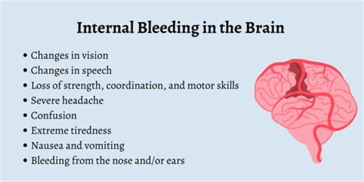 Do you feel pain with internal bleeding?