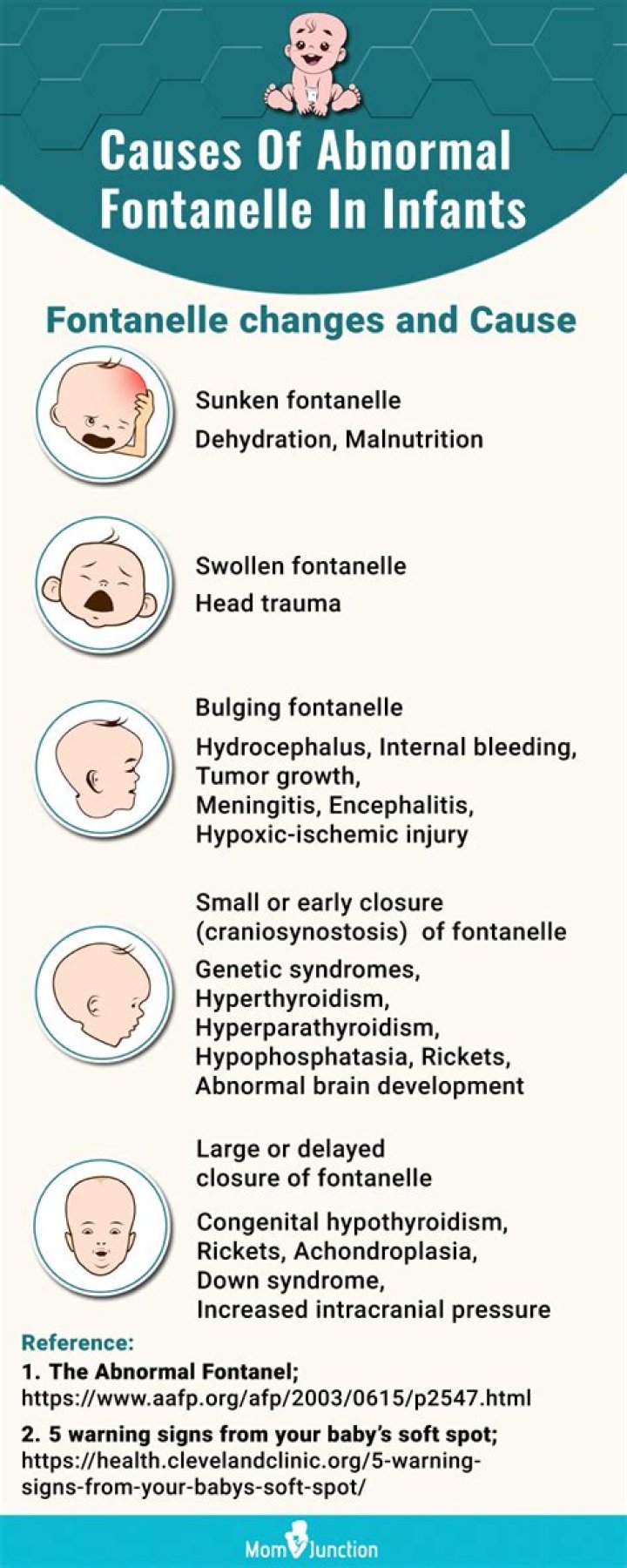Does dehydration cause bulging fontanelle?