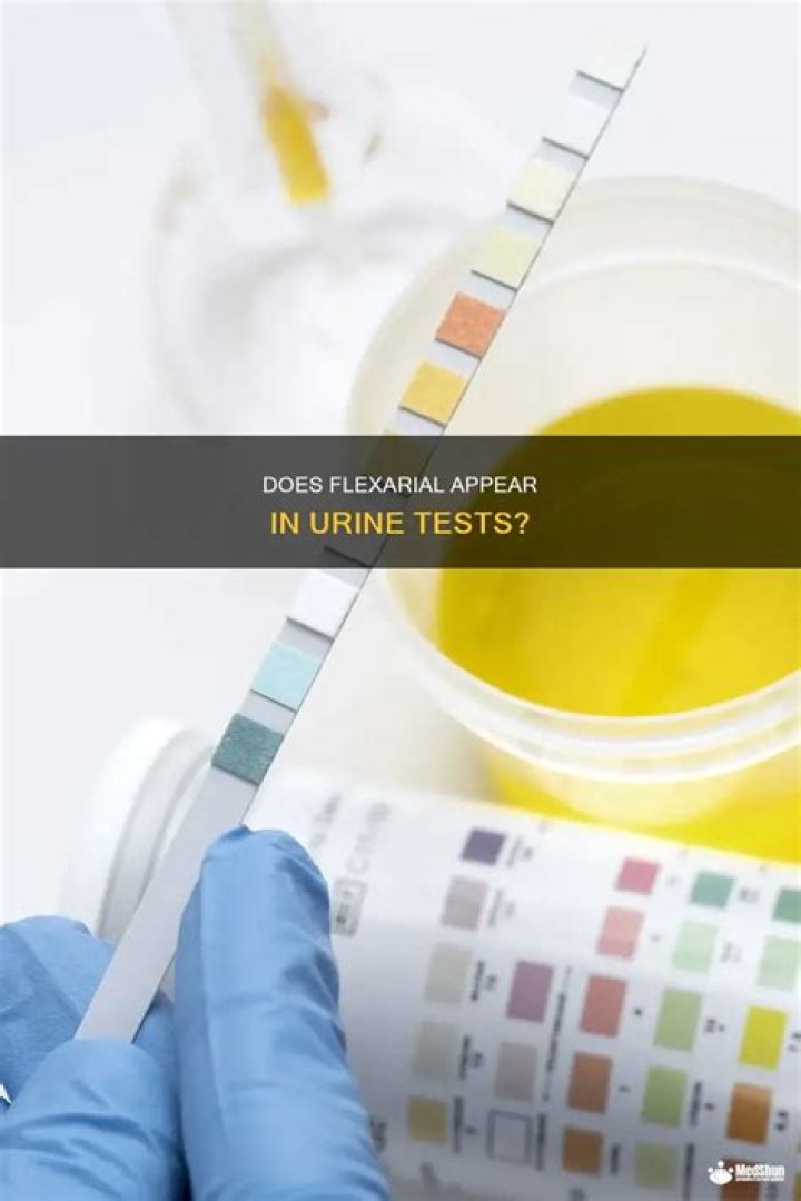 Does Flexeril show up in urine drug test?