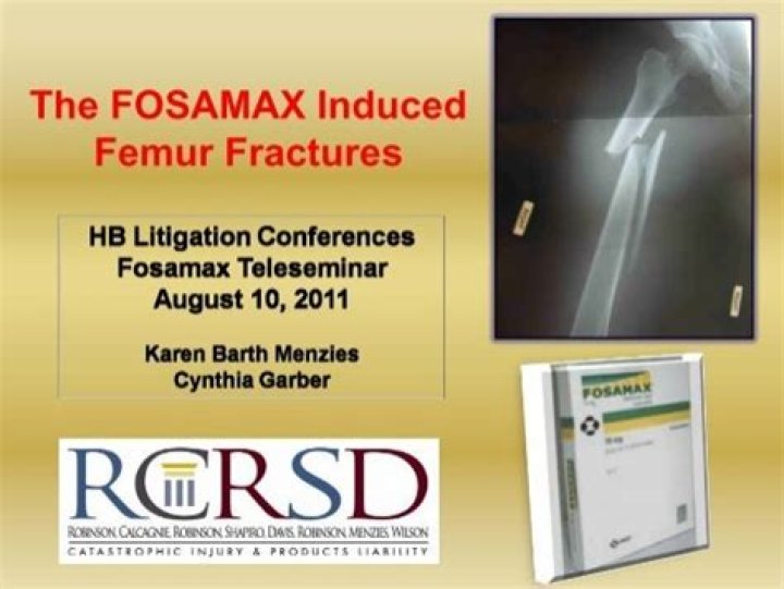 Does Fosamax cause femur fractures?