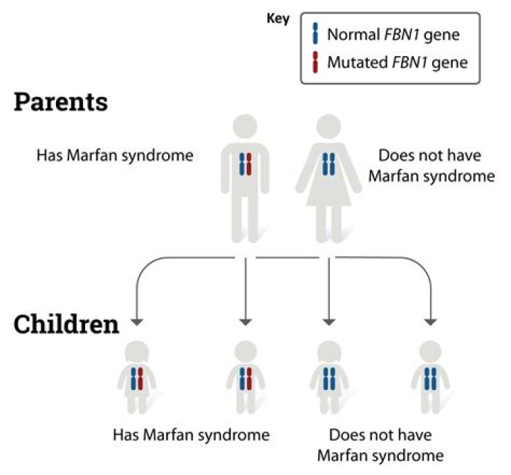 Does Marfan syndrome affect a certain gender?
