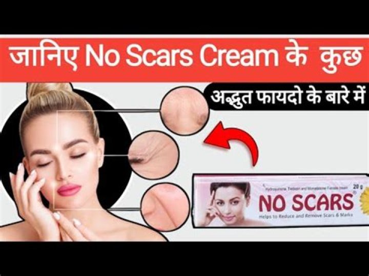Does no scars cream really work?