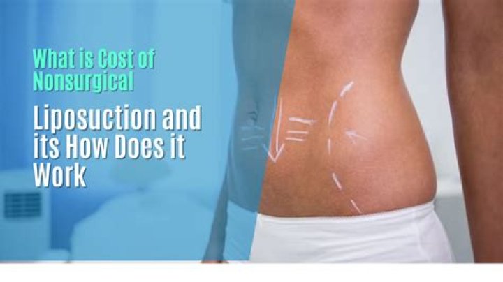 Does non surgical liposuction really work?