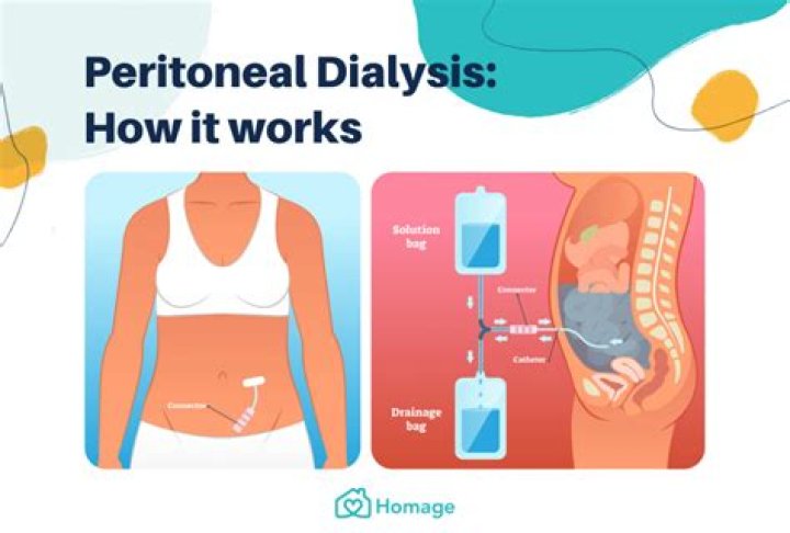 Does peritoneal dialysis use diffusion or osmosis?