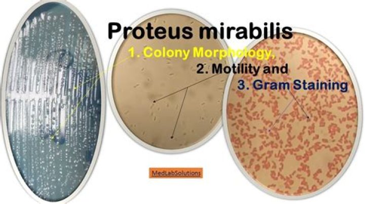 Does Proteus mirabilis have swarming motility?