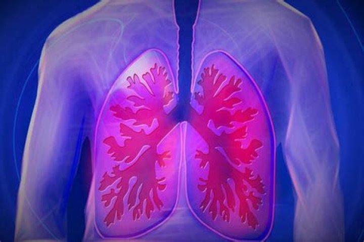 Does radon gas cause cancer?