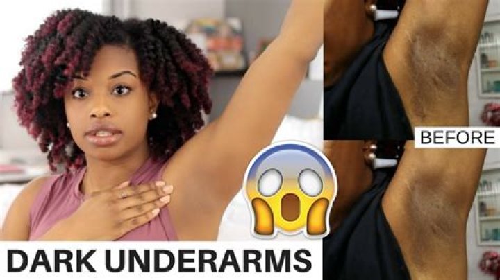 How can I remove dark underarms?