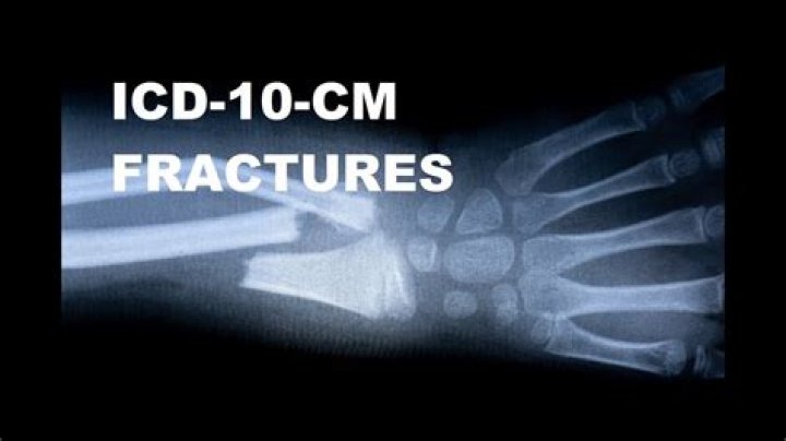 How do you code a stress fracture in ICD 10?
