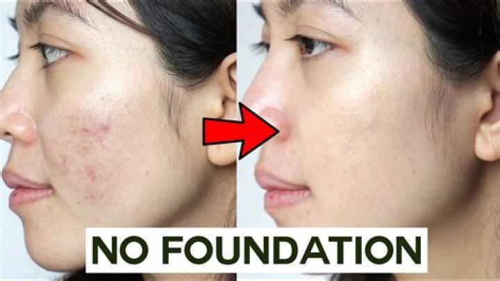 How do you cover up bad blemishes?