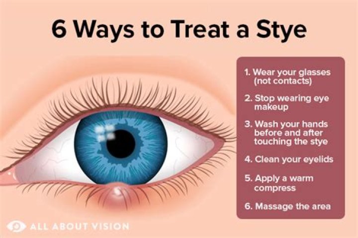 How do you get rid of a swollen corner of eye?