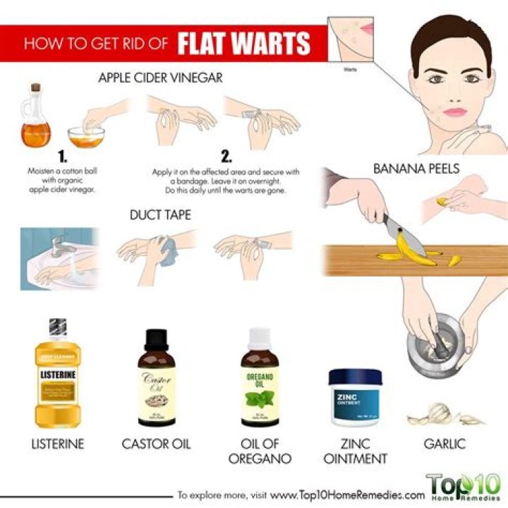 How do you get rid of flat warts?