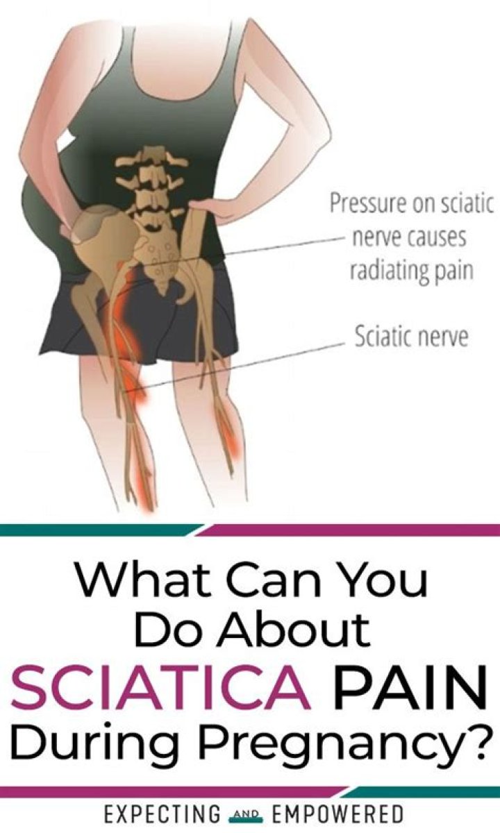 How do you get rid of sciatic nerve pain during pregnancy?
