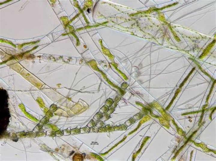 How do you identify Cladophora?