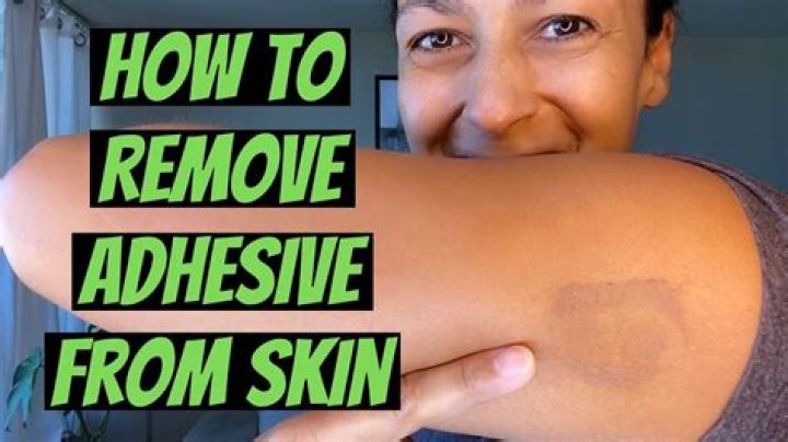 How do you remove EKG adhesive from skin?