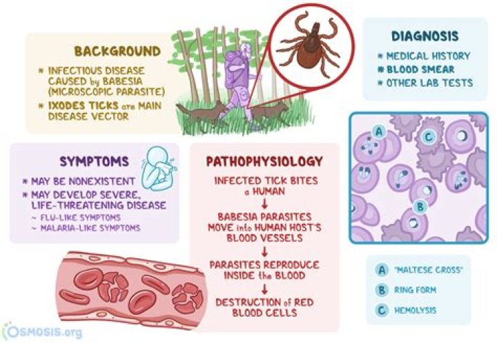How do you test for Neuroborreliosis?