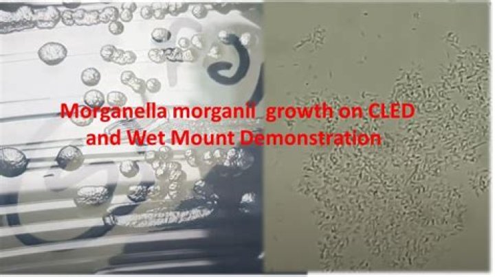 How do you treat morganella Morganii UTI?