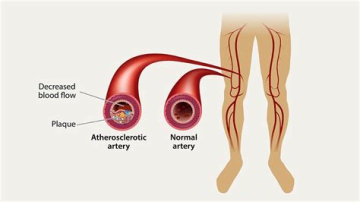 How do you treat vascular problems?
