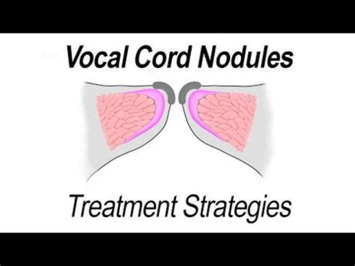 How do you treat vocal nodules in speech therapy?