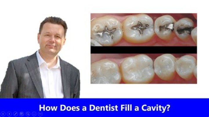 How does a dentist fix a cavity on a 2 year old?