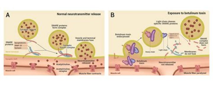How does Botox work at the neuromuscular junction?