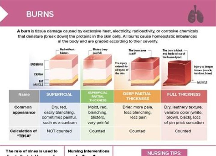 How does burns affect the neurological system?