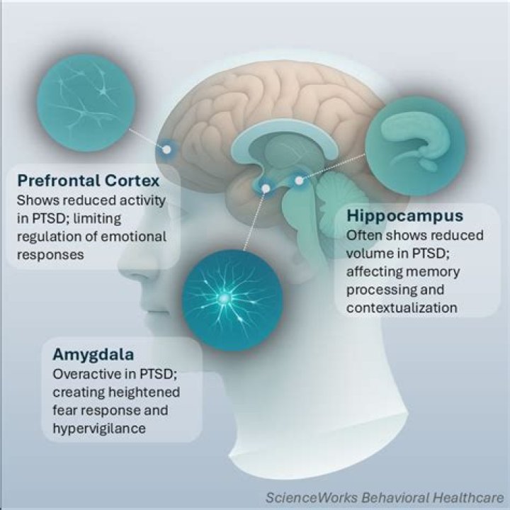How does PTSD affect the ventromedial prefrontal cortex?