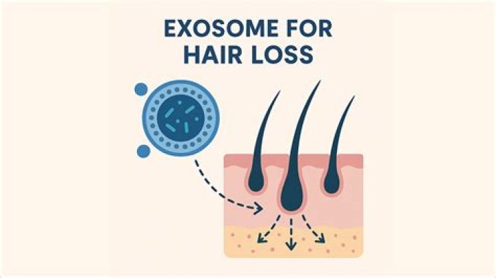 How effective is exosomes for hair loss?