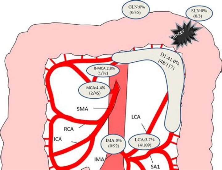 How is hepatic flexure syndrome treated?