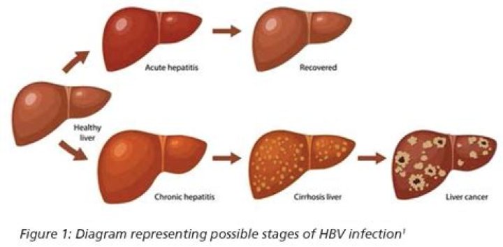 How is hepatitis B C and D spread?