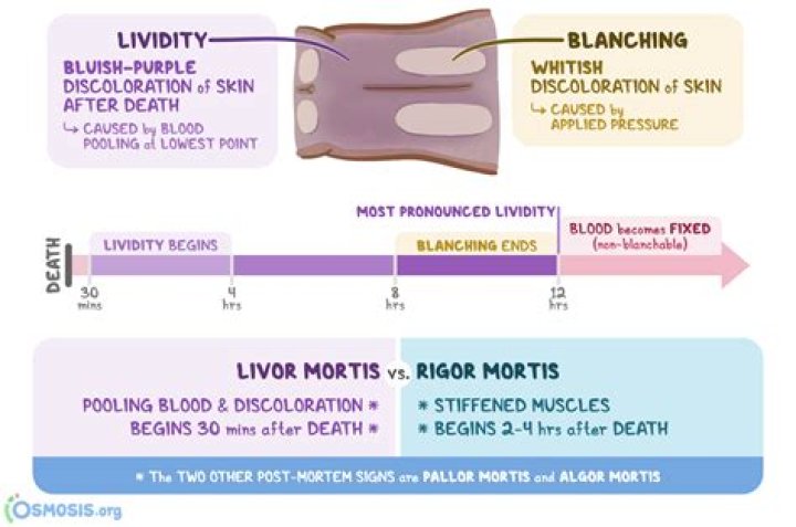 How long after death does discoloration occur?