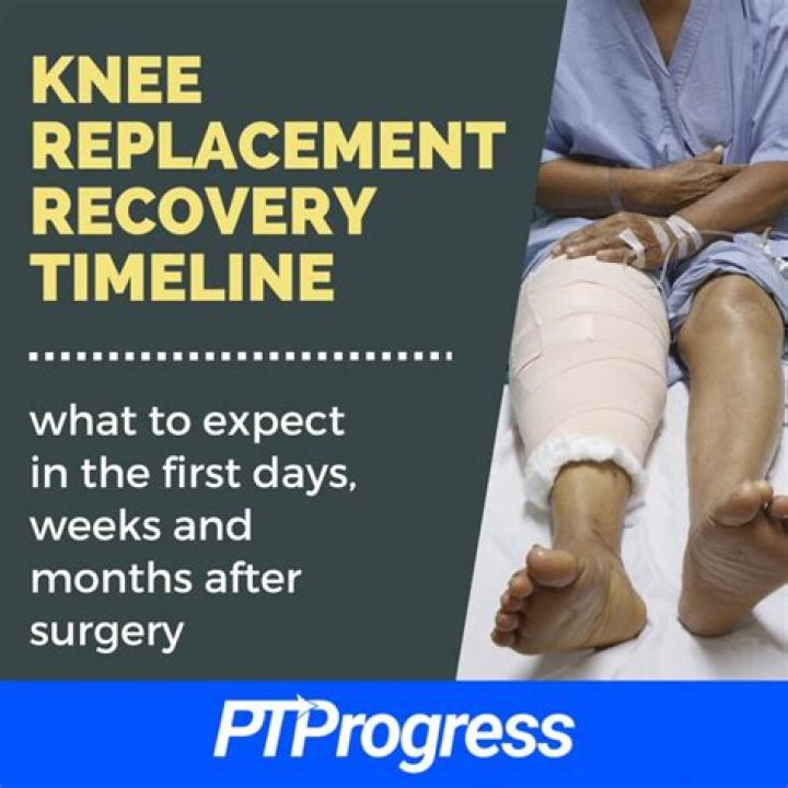 How long after knee replacement can you dance?
