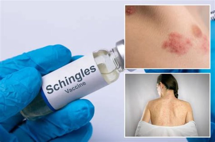 How long after shingles breakout can you get the vaccine?
