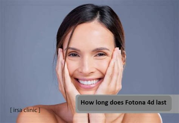 How long does fotona laser last?