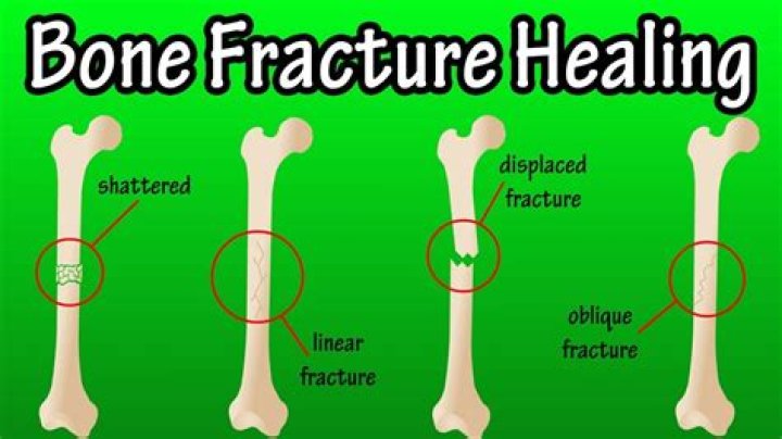 How long does it take for a puppy fracture to heal?