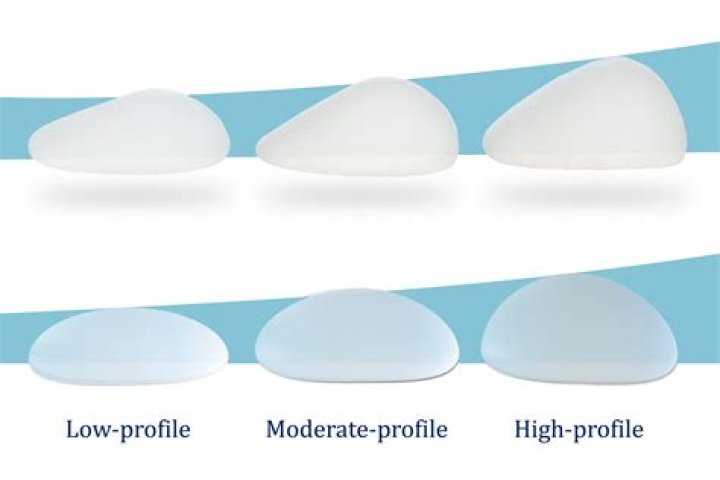 How much do breast implants cost in Indianapolis?